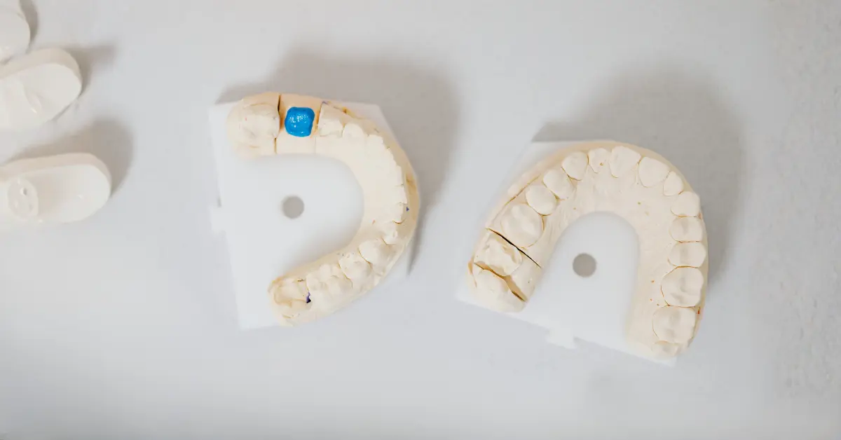 Perda de Dentes: Causas, Consequências e Soluções