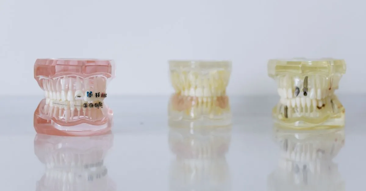 Estética Dentária: Porque o Diagnóstico é Mais Importante do Que o Tratamento