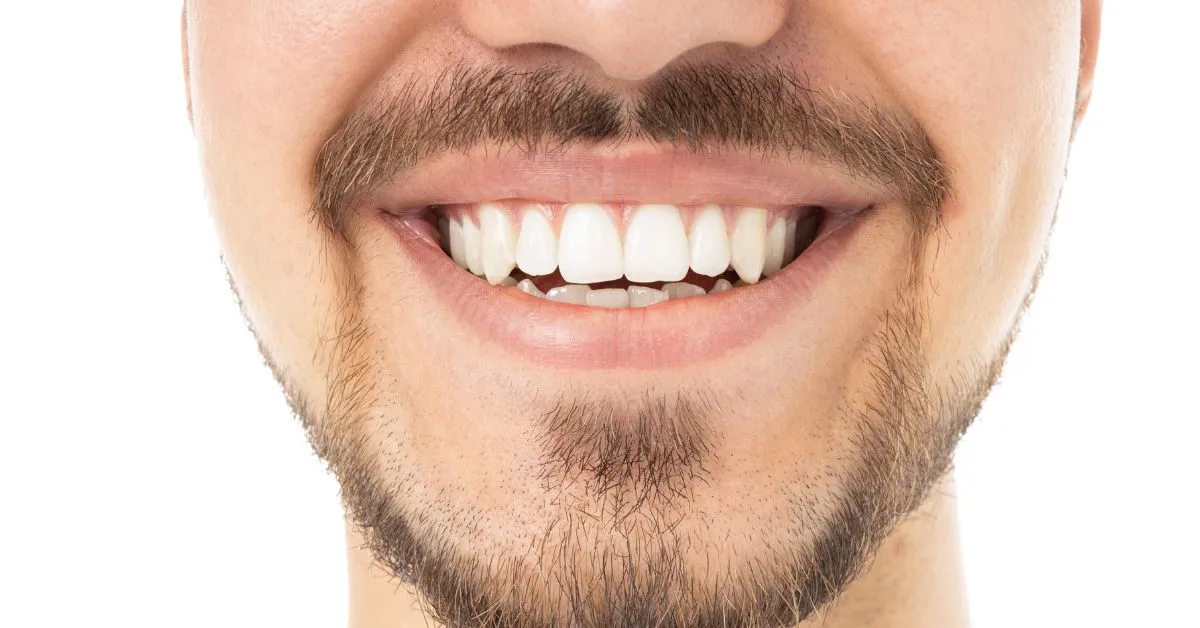 A Gengiva: A Base de um Sorriso Bonito e Saudável