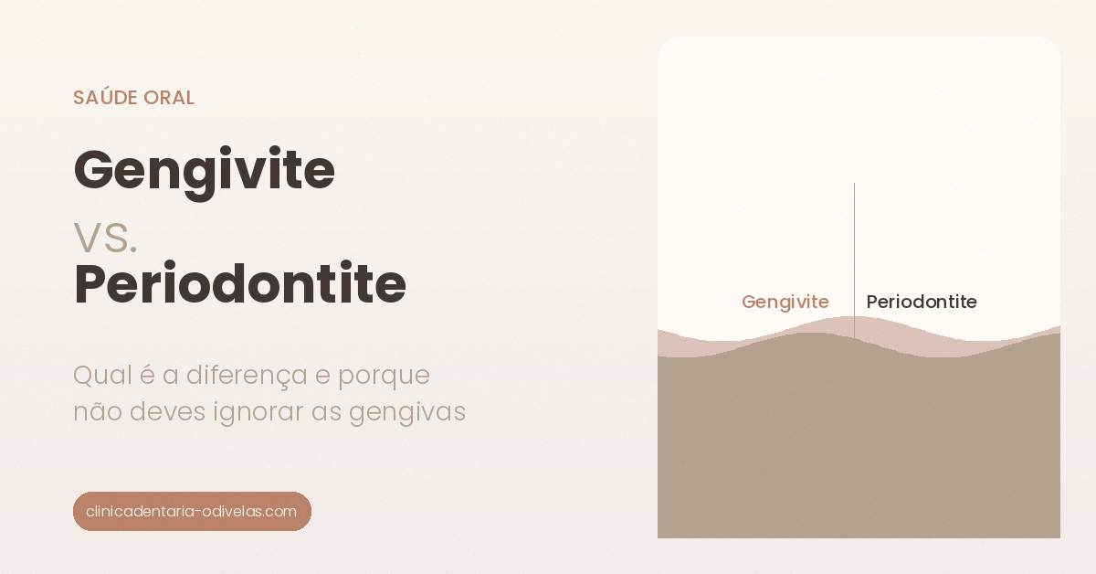 Gengivite vs. Periodontite: qual é a diferença e porque não deve ignorar as gengivas