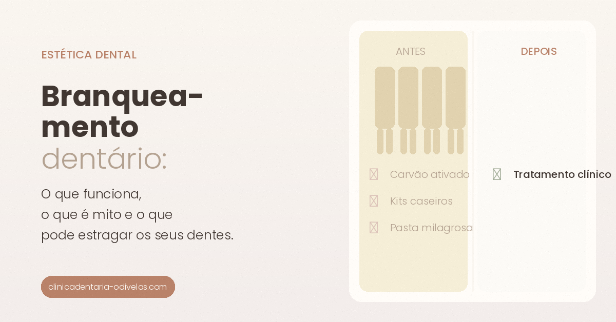 Branqueamento dentário: o que funciona mesmo, o que é mito e o que pode estragar os seus dentes