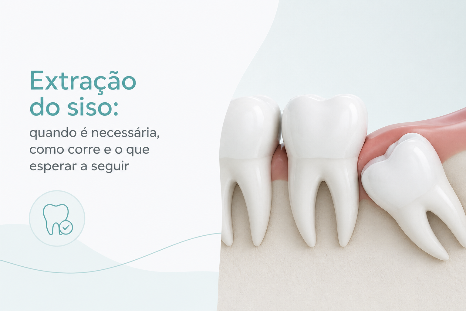 Extração do siso: quando é necessária, como corre e o que esperar a seguir