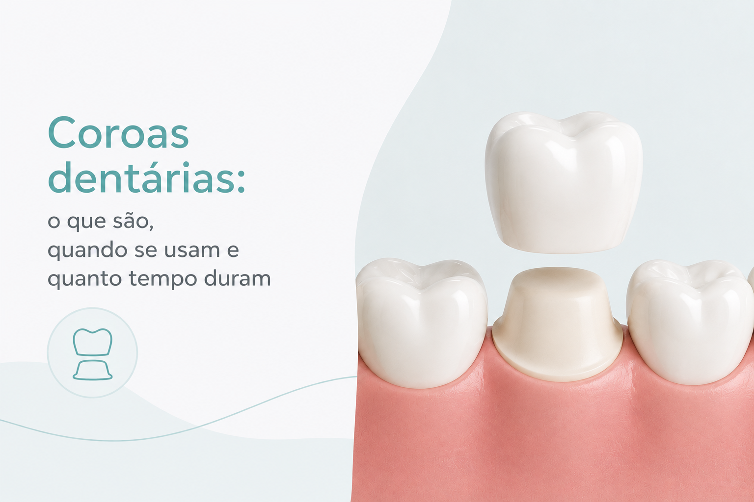 Coroas dentárias: o que são, quando se usam e quanto tempo duram